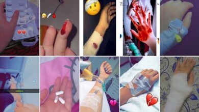 hand cut with blade fake snap